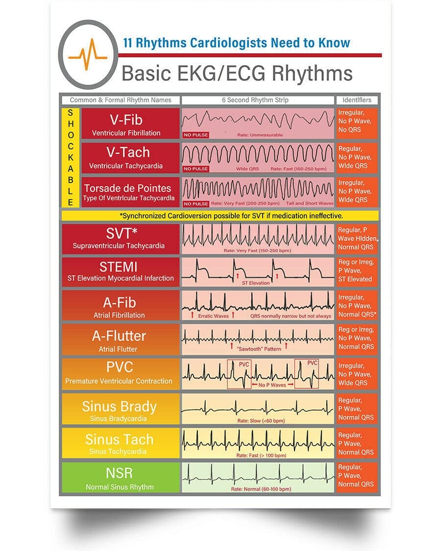 Amazon Basic EKG ECG Rhythms Knowledge Vertical Wall Art Print Poster Vintage Metal Tin Signs Poster Plaque For School Education Bar Cafe Club Home Kitchen Wall Decoration 12x8 Inches Posters Prints