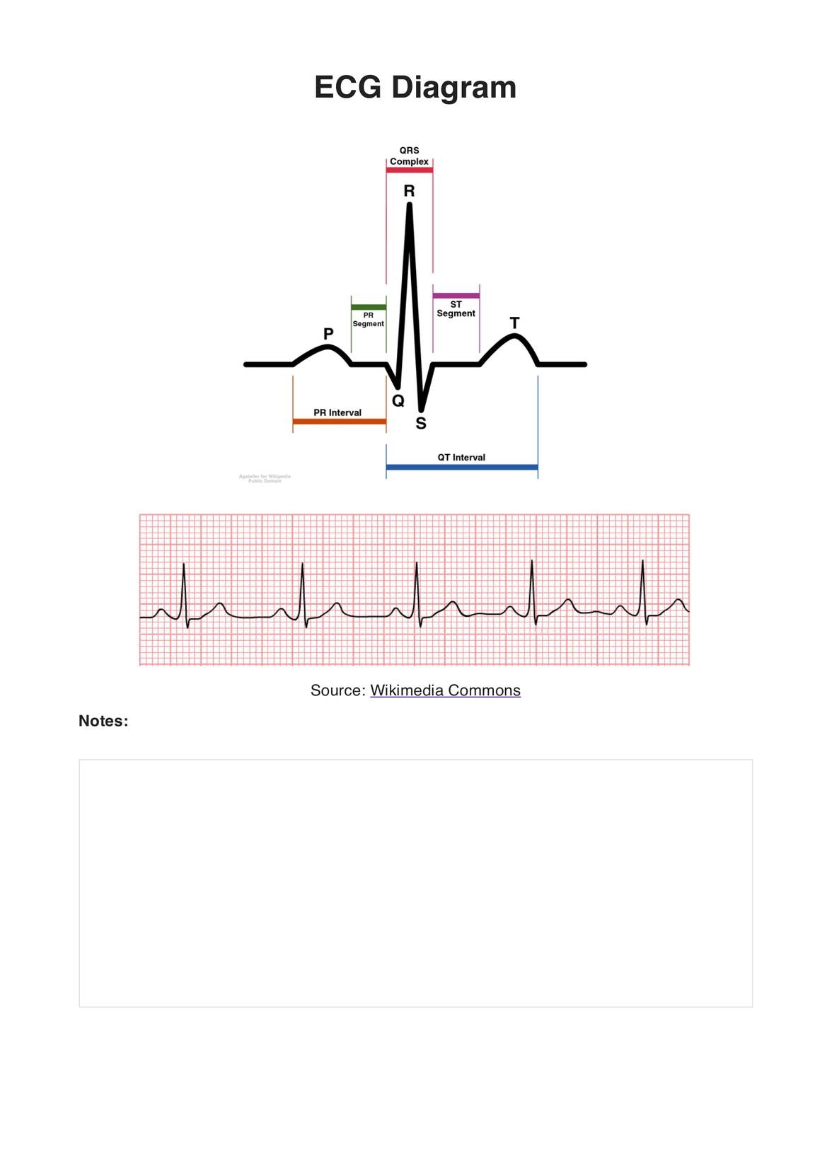 Ecg Educational Tool Printable