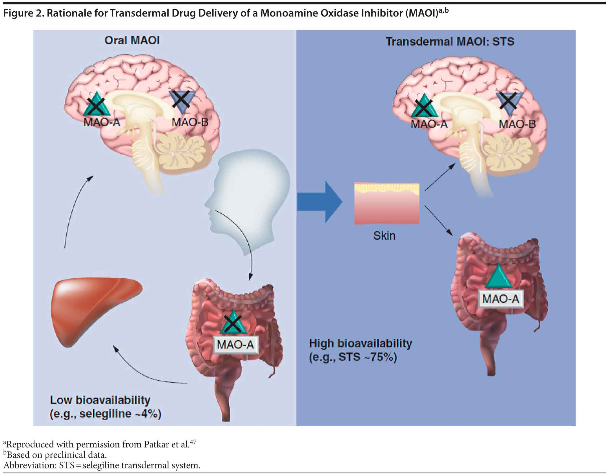 Reducing The Burden Of Difficult to Treat Major Depressive Disorder Revisiting Monoamine Oxidase Inhibitor Therapy